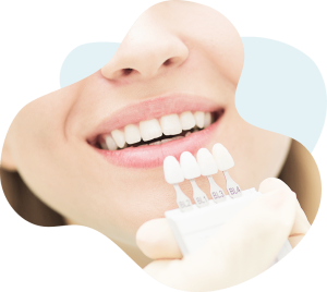 A dentist puts several colours of veneers next to the patients real teeth to see which ones match her teeth