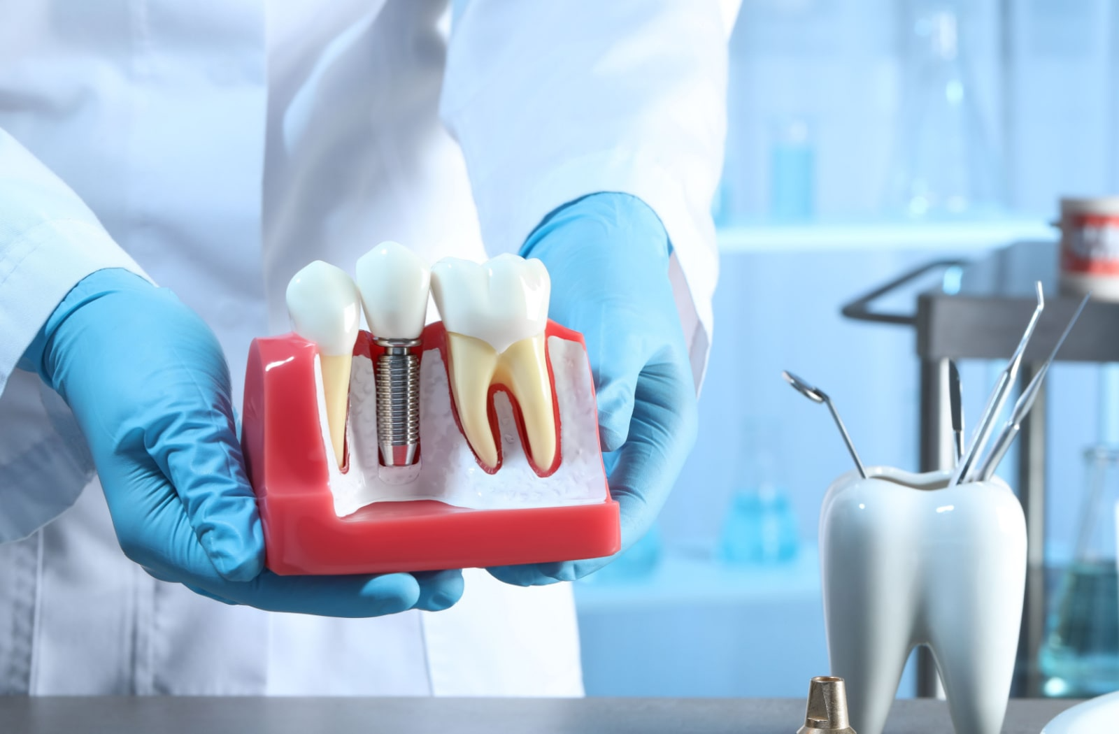 A dentist holds a hard plastic model of what a dental implant looks like inside of your jaw