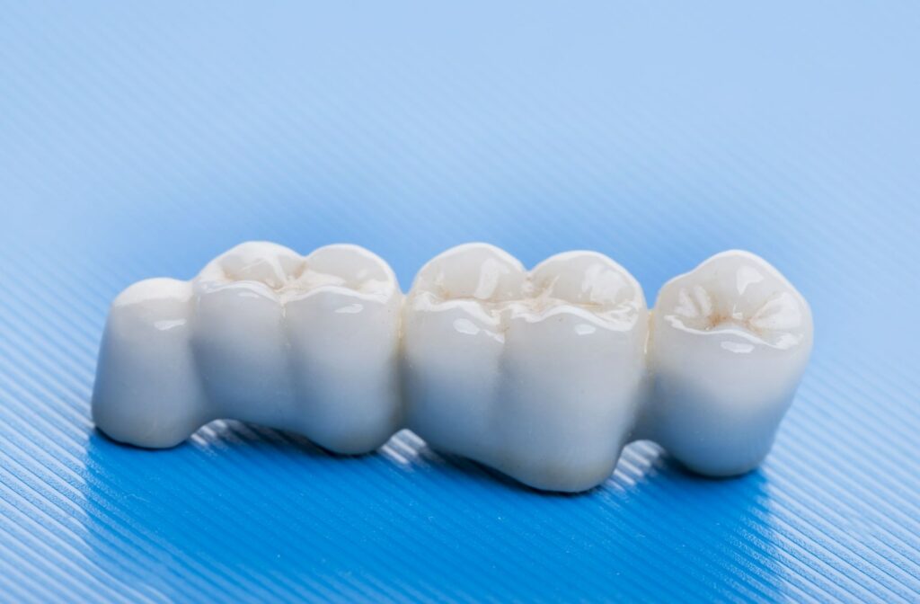 A close-up of a ceramic dental bridge against a blue background.