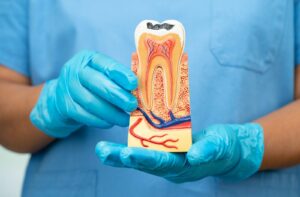 During a root canal explanation, a person in blue scrubs holds a detailed anatomical model of a tooth with roots and nerves.