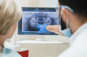 Dentist pointing at a dental X-ray on a screen.